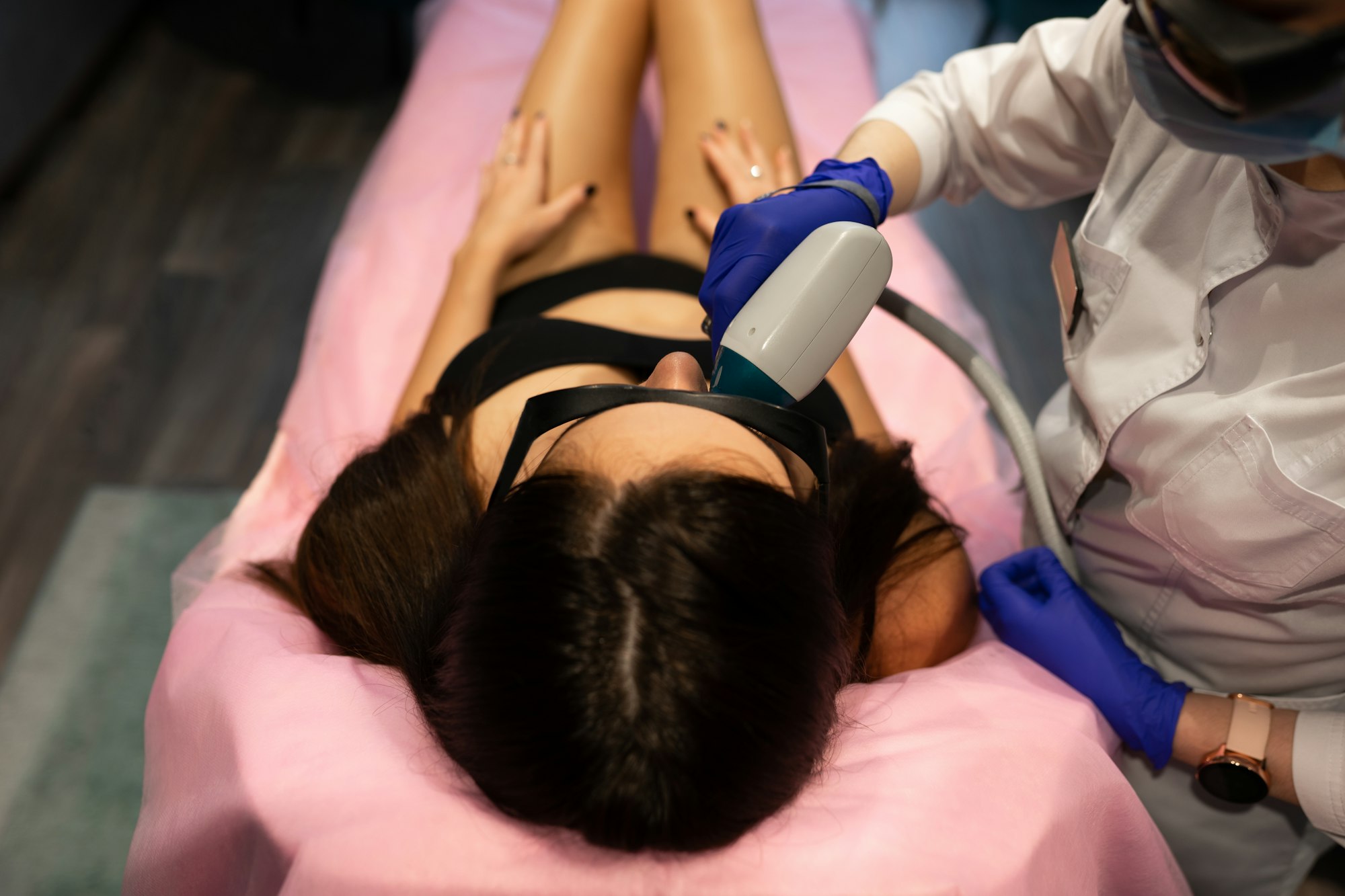 Face laser hair removal procedure